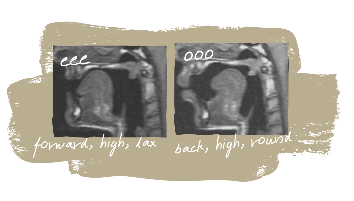 Vowels Two MRI images showing human head and neck anatomy in a side view. The left image shows the tongue high and at the front of the mouth. It is labelled "eee" and "forward, high, lax". The right image shows the tongue high and at the back of the mouth. It is